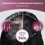 PUREHEALTH RESEARCH ReGrow - Hair Growth Vitamins - with Saw Palmetto, Biotin, Collagen, Zinc, Iron, Iodine, Selenium & More - Hair Supplements for Women & Men - 60 Capsules